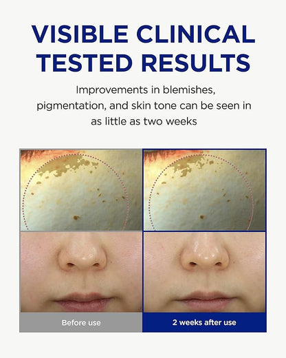 CKD Vita C Teca Blemish Shot Face Gel Mask with Vitamin C & Centella Asiatica (5ea) - Korean Hydrogel Mask for Glass Glow Skin, Dark Spot and Blemish Korean Skincare Routine