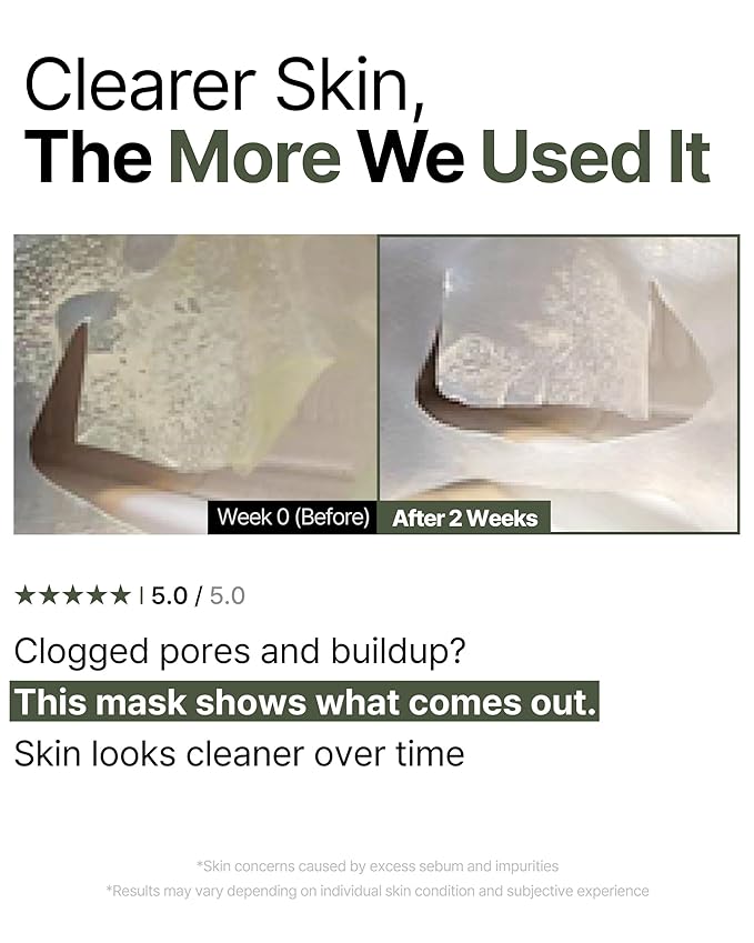 Trouble Patch Mask | Korean Face Mask ??Hydrating & Acne Face Mask for Blemish-Prone Skin, Calming Skincare & Oil Control Sheets (20ml x 4)