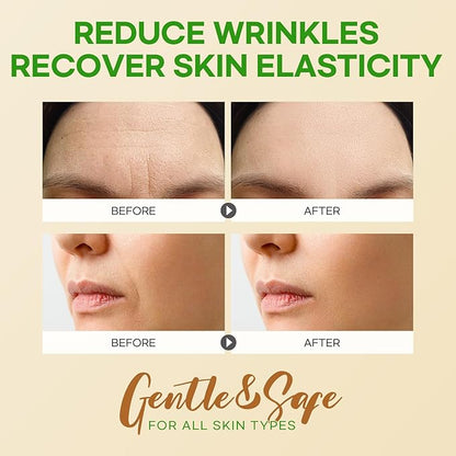 Smile Line and Forehead Wrinkle Patches: Smile Line Treatment with Aloe, Collagen, Vitamin E-Forehead Patches 12pcs, Smile Line Patches 24pcs