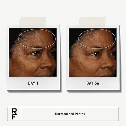 Rodan + Fields Redefine Daily Face Clay Cleanser (125 mL) | Advanced Skin Care | Exfoliating Face Wash & Face Mask for Sensitive Skin | Anti-Aging Face Cleanser for Women and Men