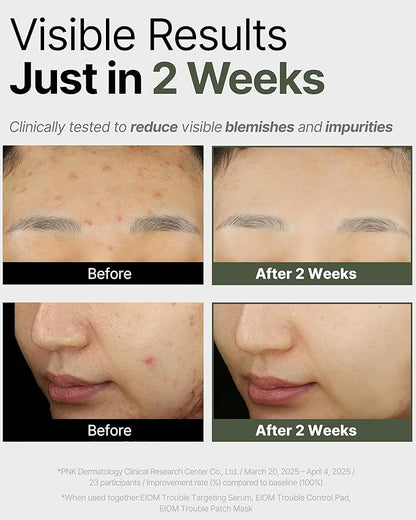 Trouble Patch Mask | Korean Face Mask ??Hydrating & Acne Face Mask for Blemish-Prone Skin, Calming Skincare & Oil Control Sheets (20ml x 4)