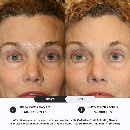 Age-Defiance Eye Cream - Day & Night Moisturizer with Nitric Oxide, Hyaluronic Acid, Complex Peptides, Ceramides - Hydrating Eye Cream for Dark Circles, Wrinkles, Fine Lines, Puffiness - 0.5 oz.