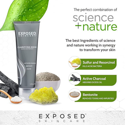 Exposed Skin Care Activated Charcoal Face Mask to Purify Skin, Regulate Oil Production and Visibly Minimize Pores ??Clarifying Acne Treatment Mask with Bentonite and Sulfur (1.7 Fl. Oz.)